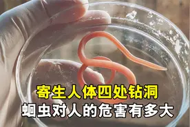 寄生人体四处乱钻，胃酸免疫繁殖力超群，蛔虫对人体的危害有多大视频封面