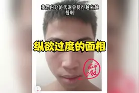 纵欲过度的面相视频封面