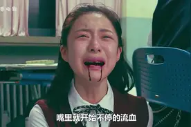 女孩只因为偷吃了一颗果冻，嘴里就开始不停的流血