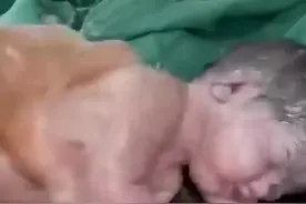 刚刚出生的宝宝就没有了呼吸，医护人员竭尽全力的抢救宝宝最终视频封面