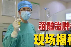肿瘤微波消融术，一分钟消灭一个病灶，不开刀，精准灭活！视频封面