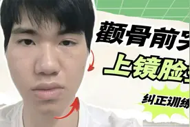 快速修正【嘴歪/颧骨一高一低】，摆脱歪下巴，改善大小脸！视频封面