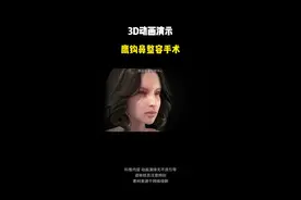 3D动画演示鹰钩鼻整容手术视频封面