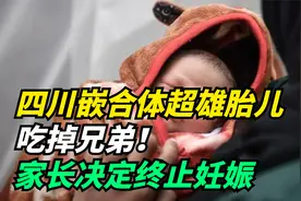 四川嵌合体超雄胎儿，吃掉兄弟！家长决定终止妊娠，网友放心了！视频封面