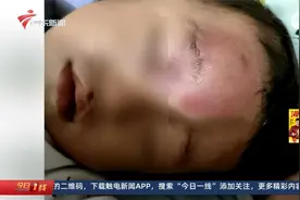 男童在机构被老师拖拽受伤，相关部门介入调查视频封面