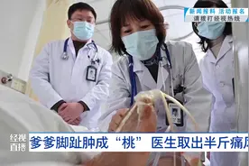 爹爹脚趾肿成“桃” 医生取出半斤痛风石视频封面