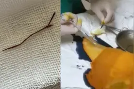 女子睡凉席脚背被扎入四厘米竹刺，医生：严重时可能会危及生命视频封面