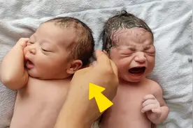 双胞胎刚出生其中一个竟是唐氏儿，光看外表你能猜出是哪个吗？视频封面