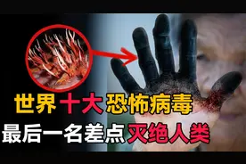世界十大最恐怖的病毒，每一种都曾造成大规模死亡，新冠没有上榜视频封面