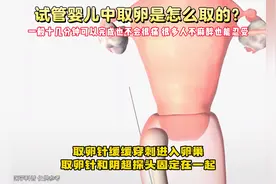 试管婴儿中取卵是怎么取的？会不会很痛？试管不易，愿见者好孕！
