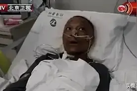武汉两位医生为什么变成“黑人”？肤色还会恢复正常吗？一文解答图片