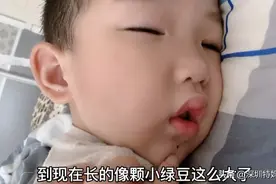 儿子下巴的痣有人说是发财痣，有人说是君王痣，纠结到底要不要点视频封面