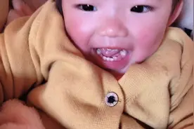 一岁半宝宝，乳牙长成歪的，以后换牙还会照原样长吗？视频封面