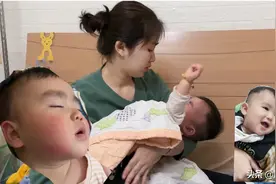 一刮风宝宝脸上就红肿，宝妈看到这漂亮的小脸蛋变成这样实在心疼视频封面