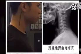 实用啊~几分钟教你矫正颈椎曲度变直！视频封面