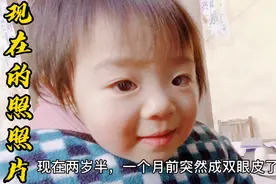 北漂夫妻都是单眼皮，2岁女儿突然变成双眼皮了，好神奇好漂亮！视频封面