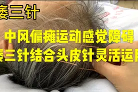 靳三针：中风偏瘫运动感觉障碍，痿三针结合头皮针灵活运用视频封面