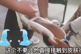 孩子不小心把脚摔骨折了，这大热天的打个石膏太难受了晓晓真心疼视频封面