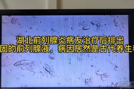 湖北前列腺炎病友治疗后排出凝固的前列腺液，病因是古代养生秘籍视频封面