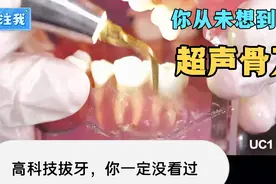 超声骨刀拔牙操作流程和方法，不仅可以拔牙还可以剥鸡蛋🥚视频封面