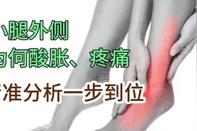 为什么小腿外侧酸胀、疼痛？不出意外，就2个原因，您的腰5、骶1视频封面