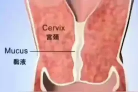 妇科检查动画演示视频封面