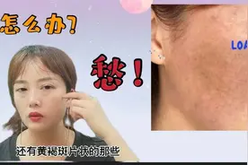 60岁的大姐姐祛斑后素颜出镜！皮肤不是一般的好！又白又透！视频封面