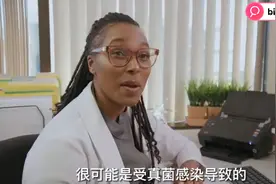 真菌感染导致美女死皮不断视频封面