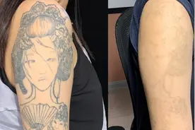 济南小姐姐纹花臂影响生活后悔了洗掉，劝年轻人纹身要谨慎！视频封面