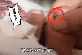 有没有人知道，脚指甲盖发黑还出水是怎么回事？视频封面
