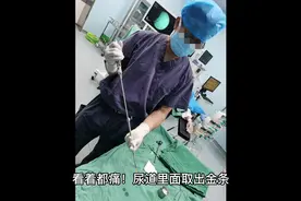 惊险的尿道异物  隔着屏幕都觉得痛  为他捏一把汗视频封面