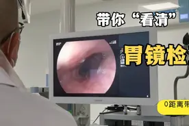 带你看第一视野⊙ω⊙了解胃镜检查过程视频封面