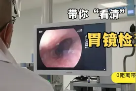 带你看第一视野⊙ω⊙了解胃镜检查过程