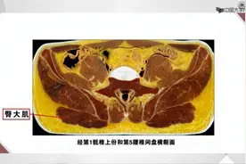 36盆壁断层解剖视频封面