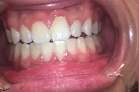 口腔牙齿检查视频封面