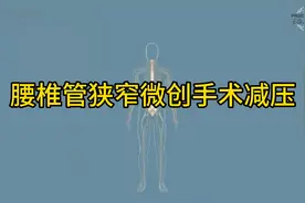 腰椎管狭窄微创手术减压动画演示！视频封面