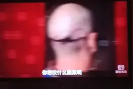 7种逼真的纹身。用钩子来掩盖伤疤？立体上方长了个胳膊？视频封面