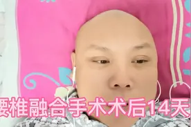 腰椎开放手术后的心情，伤口愈合情况，今天14天拆线了。视频封面