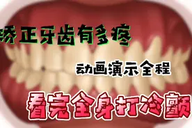 动画演示矫正牙齿，看完全身打冷颤视频封面