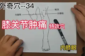 经外奇穴--膝关节疼痛可以试试内膝眼。视频封面