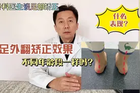 足外翻矫正效果，不同年龄段一样吗？足外翻都有哪些表现？视频封面