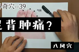 经外奇穴--足背肿痛，试试八风穴。视频封面