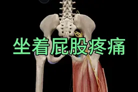坐骨结节疼痛，快速治愈的方法！视频封面