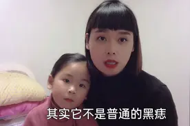 宝宝脚上莫名长个黑痣，去医院医生却让赶紧手术，没想到危害挺大视频封面