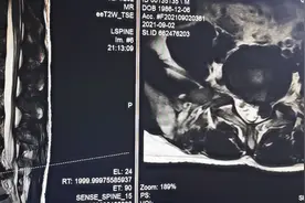 简单的教大家如何看一个磁共振片子视频封面