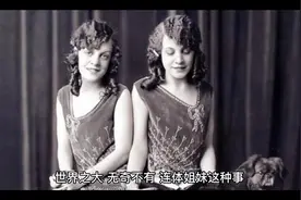 连体姐妹40多年，嫁同一丈夫，婚后日子过得太心疼视频封面