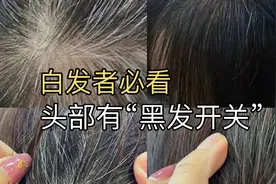 头部有一个“黑发开关”每天梳通50下按摩50下，快速白转黑视频封面