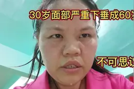 30岁面部严重下垂成60岁，经历了什么？减肥变美逆袭目标96斤。
