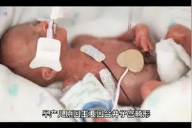 早产的原因是什么视频封面