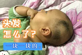 娃娃的头发一块一块的，到底是怎么了？别人说是理发伤到了毛囊？视频封面